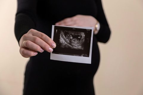 Gestante segurando a imagem de um exame de ultrassom obstétrico